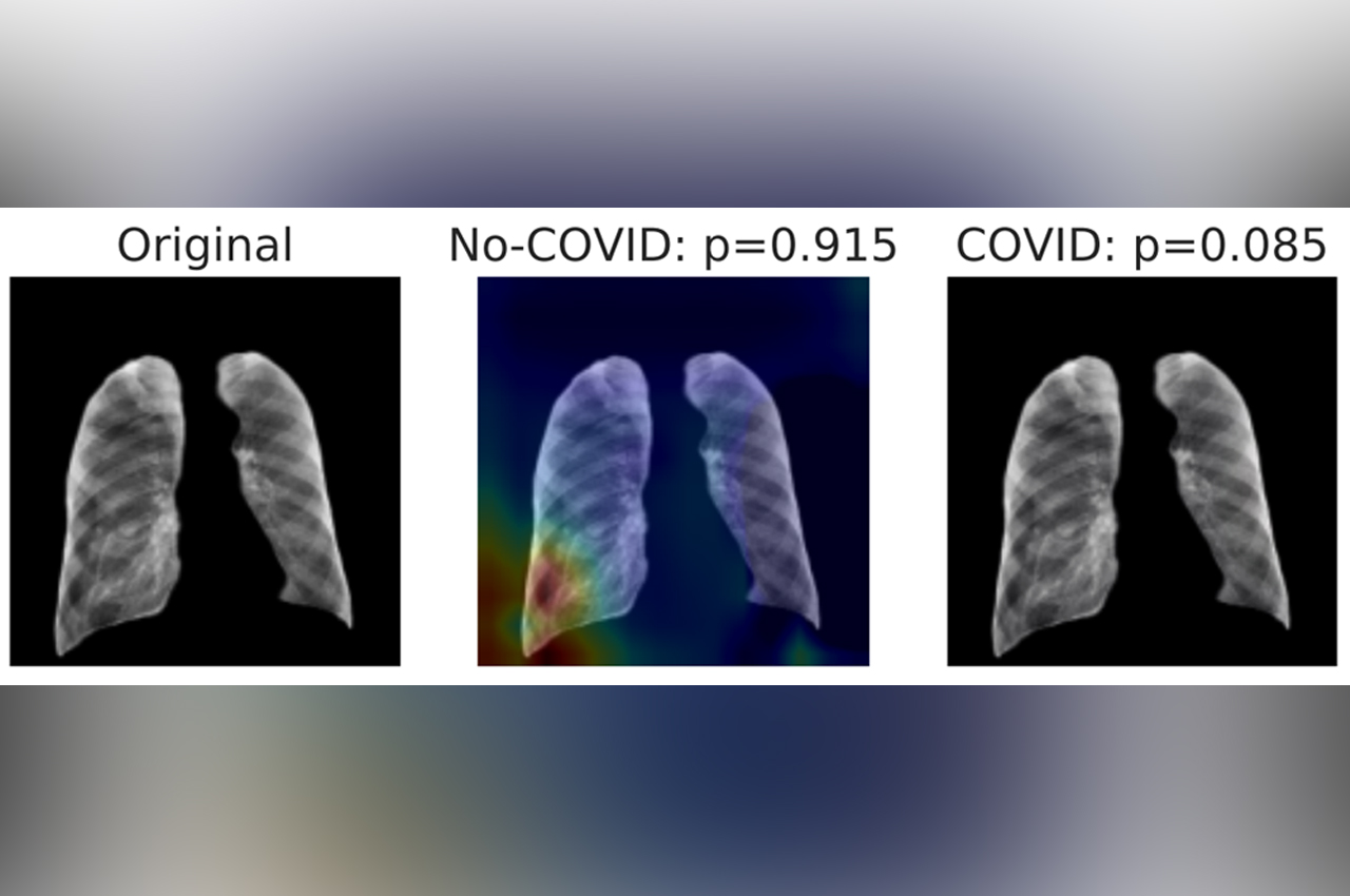 Detección de COVID a partir de imágenes de Rayos X, de Tórax